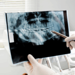 types of oral surgery