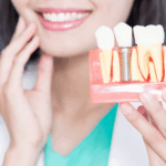 dental-implant-after-extraction