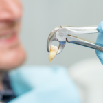 what-does-a-healthy-tooth-extraction-look-like