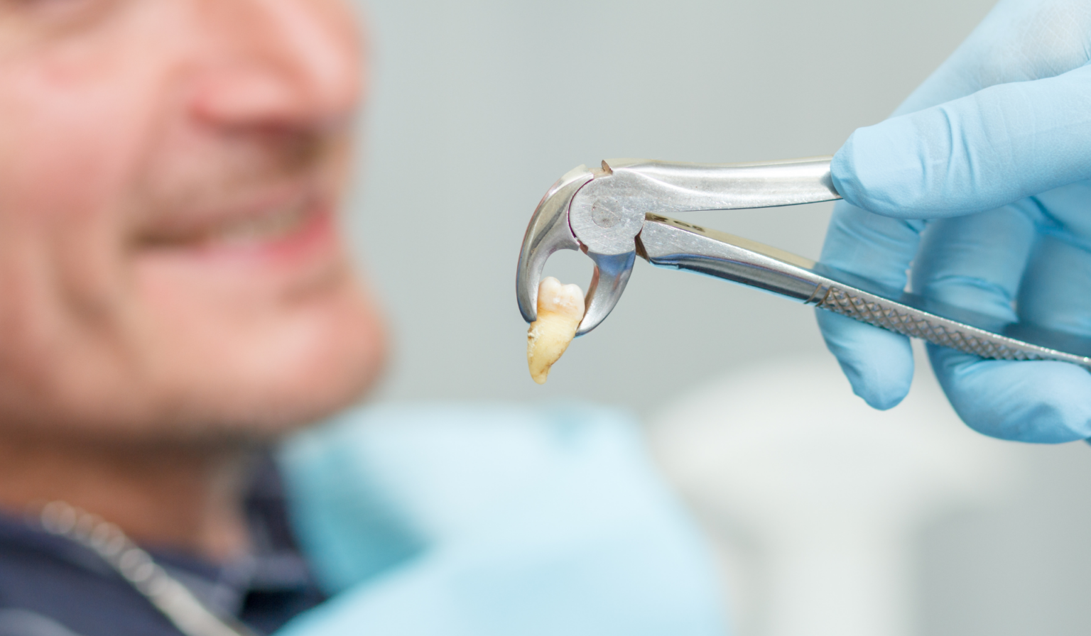 Tooth Pulled What Does a Healthy Tooth Extraction Look Like? | Bergen Oral Surgery