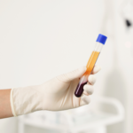 prf-in-oral-surgery