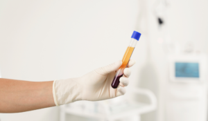 prf-in-oral-surgery