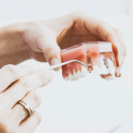 Dental Implants Affect Nutrition and Daily Life