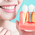 woman smiling holding a dental implant